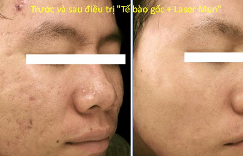 Hình 4