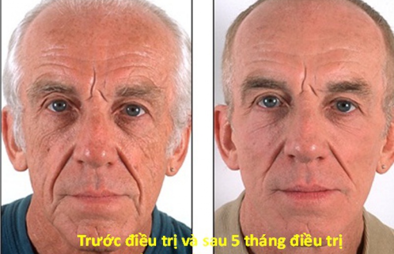 Hình 6
