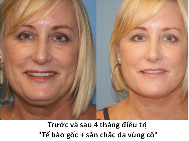 Hình 10