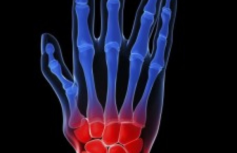 Tế Bào Gốc có thể Ngăn ngừa Viêm Khớp